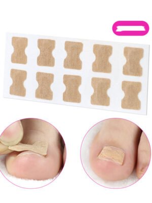 Glue-free orthopaedic nail fixation device