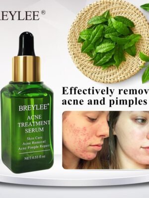 BREYLEE Acne Treatment Serum Face Facial Anti Acne Scar Removal Cream Skin Care Whitening Repair Pimple Remover For Acne