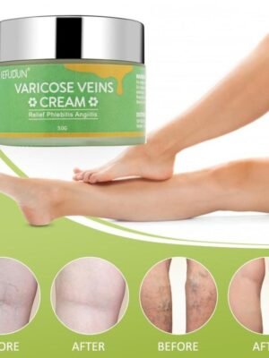 Vein Cream Red Blood Streaks Repair Earthworm Leg Bruises Bulge Relief Pain Safflower Skin care lotion Varicose Cream
